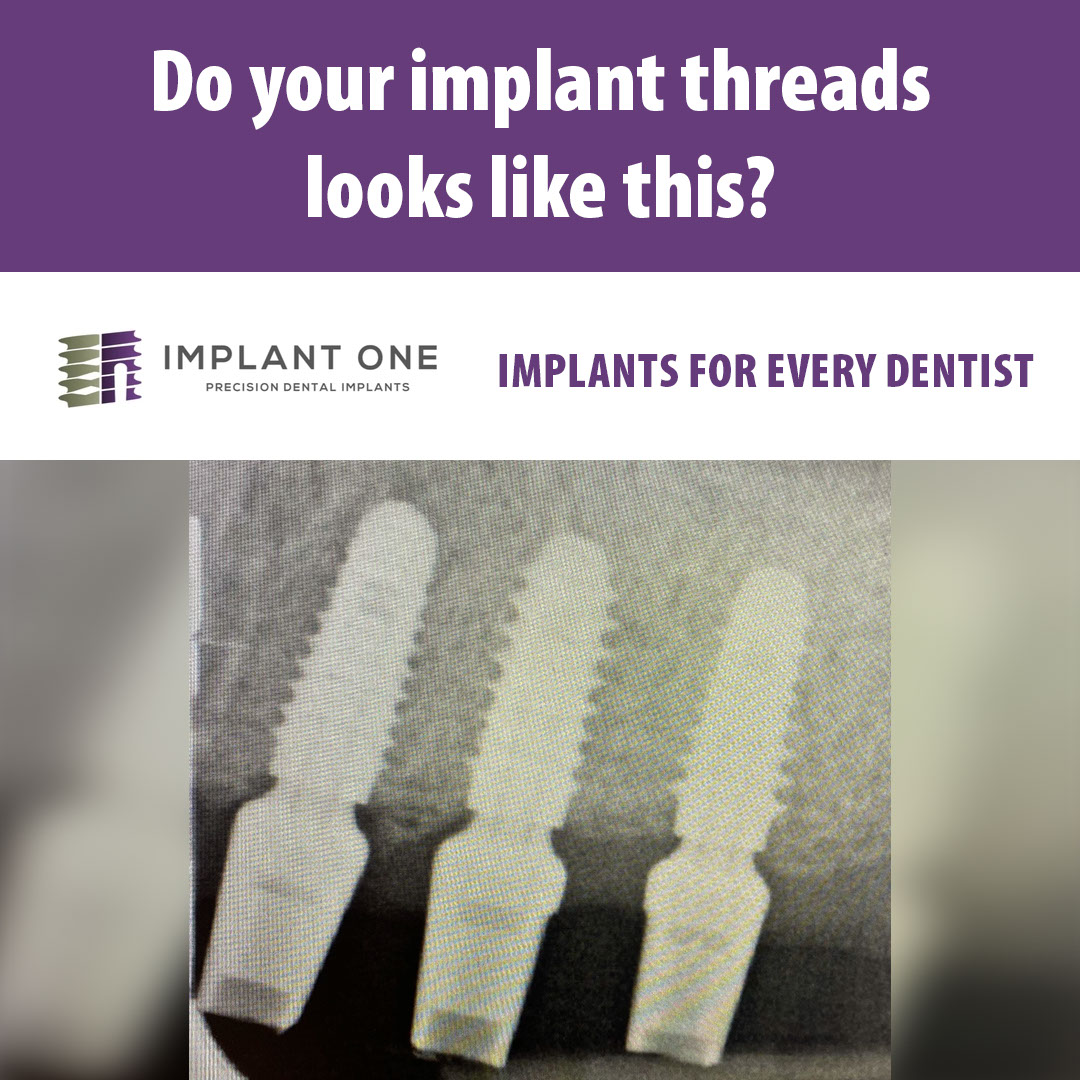 Do your implant threads looks like this