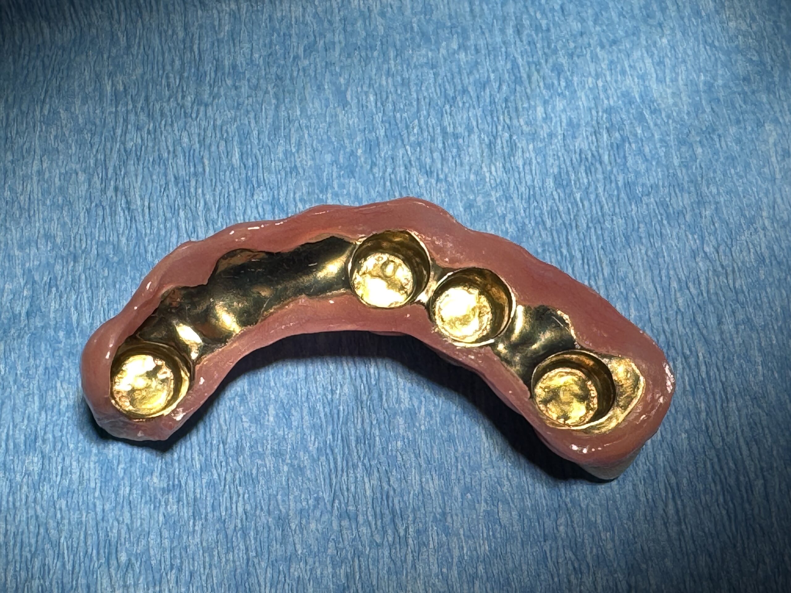 9Intaglio